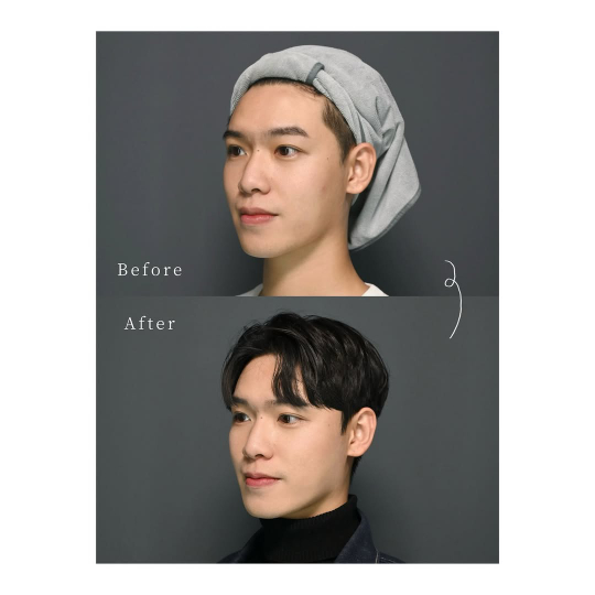 術後心得：投資在細節裡的「透明感」 ｜Allen